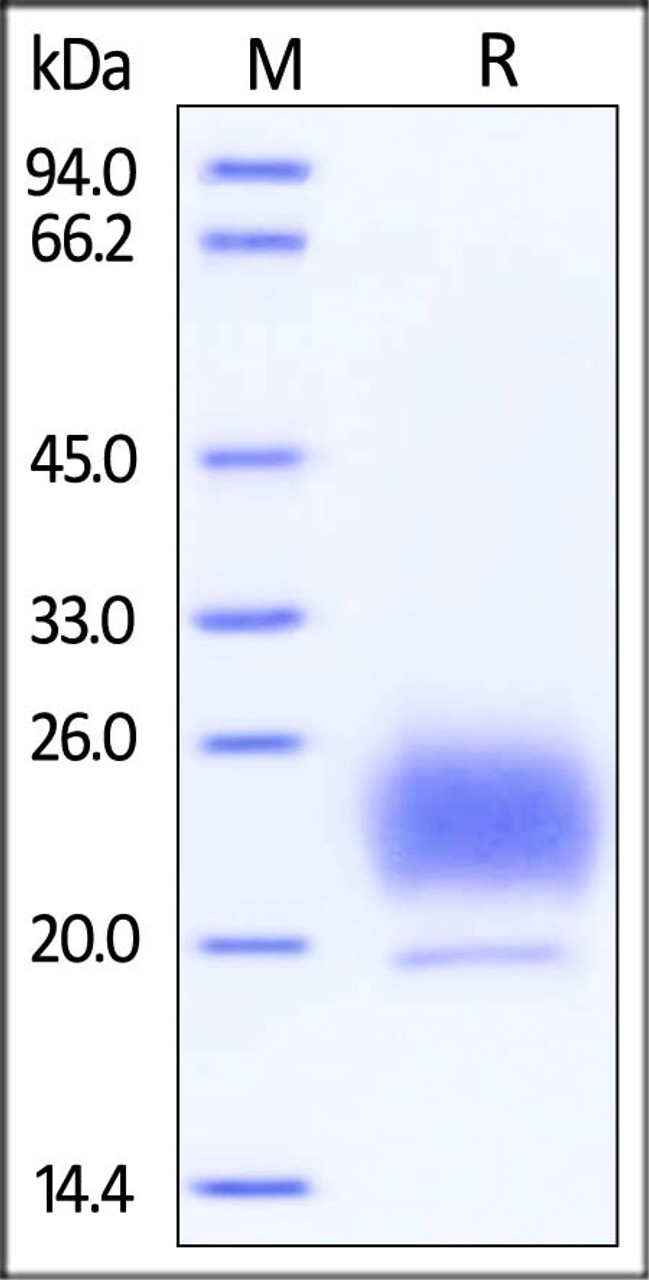 Human HE4, His Tag on SDS-PAGE under reducing (R) condition. The gel was stained overnight with Coomassie Blue. The purity of the protein is greater than 95%.