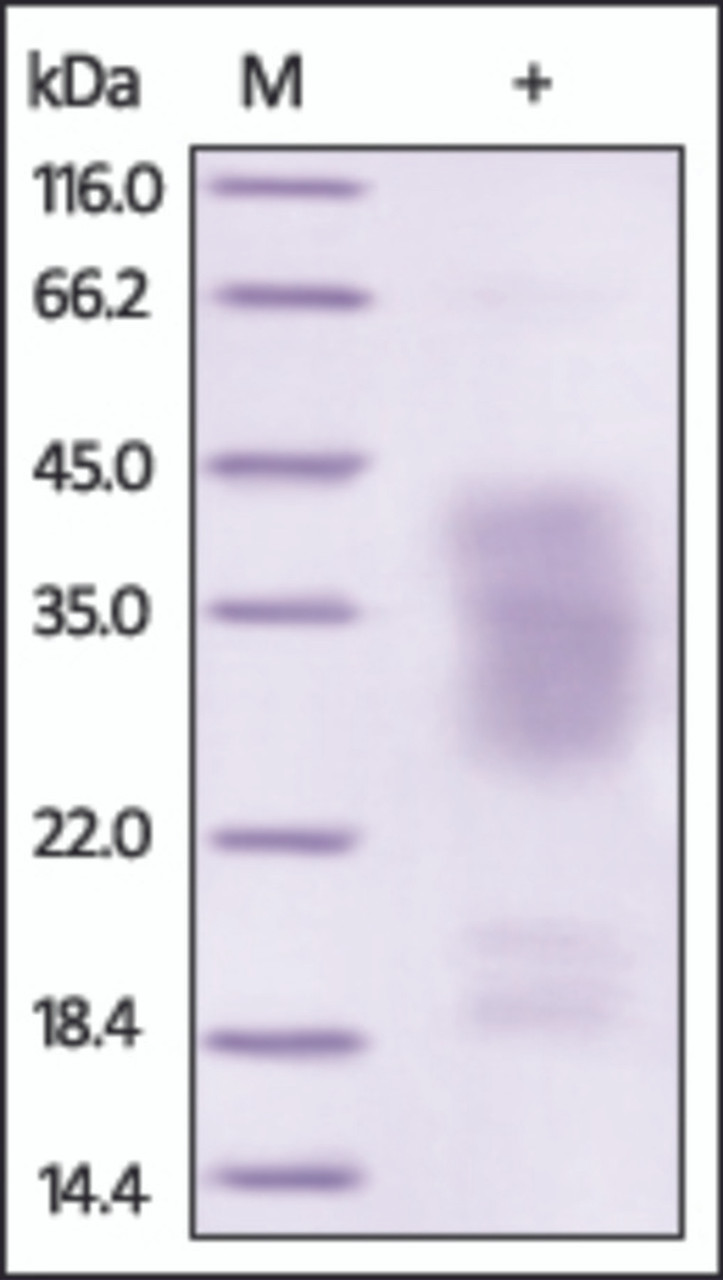 The purity of rh HVEM, twin strep tag was determined by DTT-reduced (+) SDS-PAGE and staining overnight with Coomassie Blue.