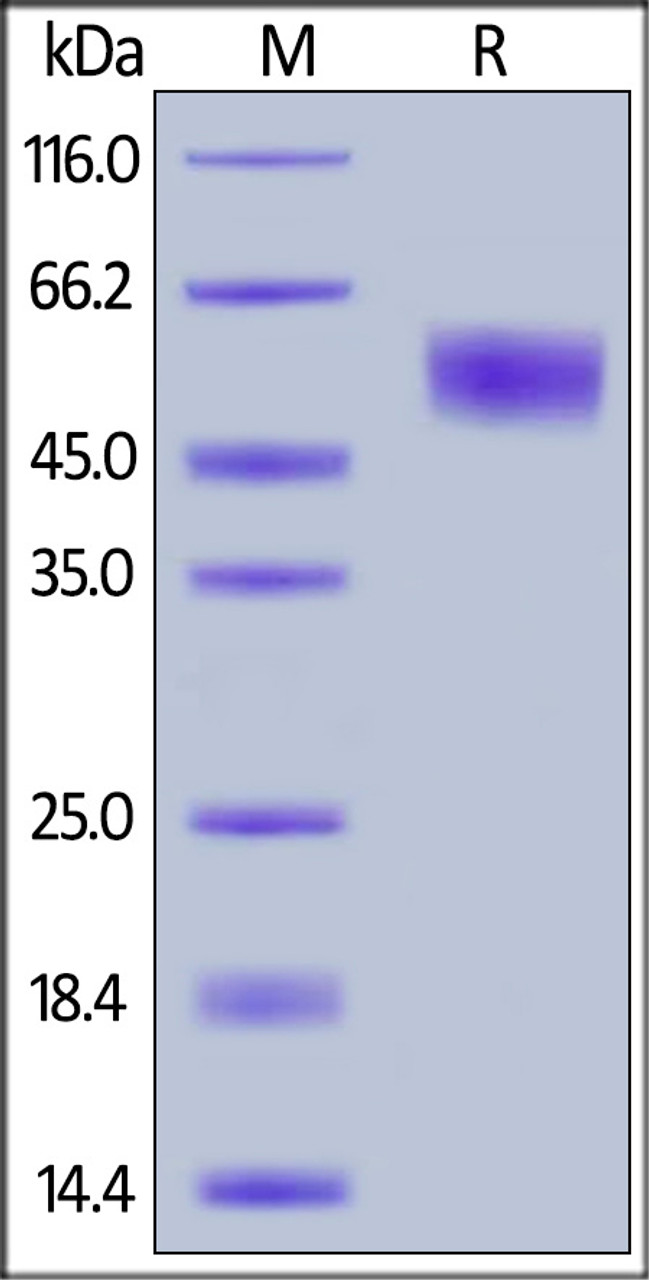 Human IL-1 RII, His Tag on SDS-PAGE under reducing (R) condition. The gel was stained overnight with Coomassie Blue. The purity of the protein is greater than 98%.