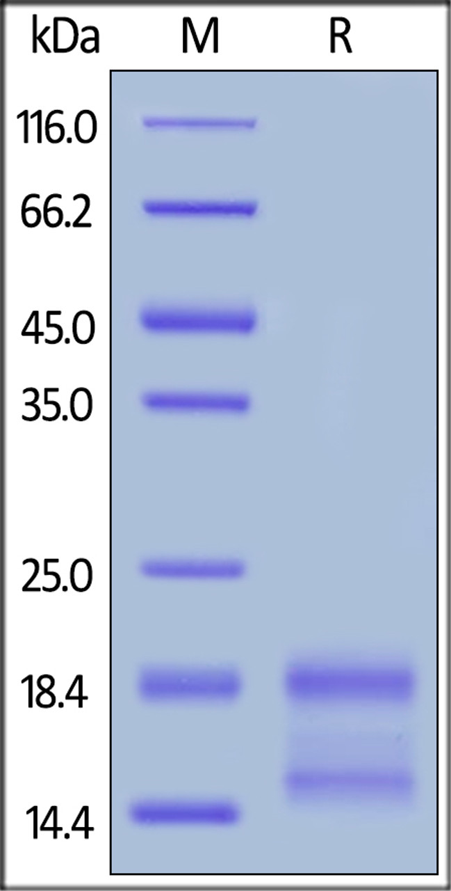 Human IL-4, Tag Free on SDS-PAGE under reducing (R) condition. The gel was stained overnight with Coomassie Blue. The purity of the protein is greater than 90%.