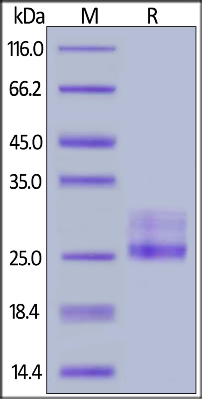 Human IL-6, Tag Free on SDS-PAGE under reducing (R) condition. The gel was stained overnight with Coomassie Blue. The purity of the protein is greater than 98%.
