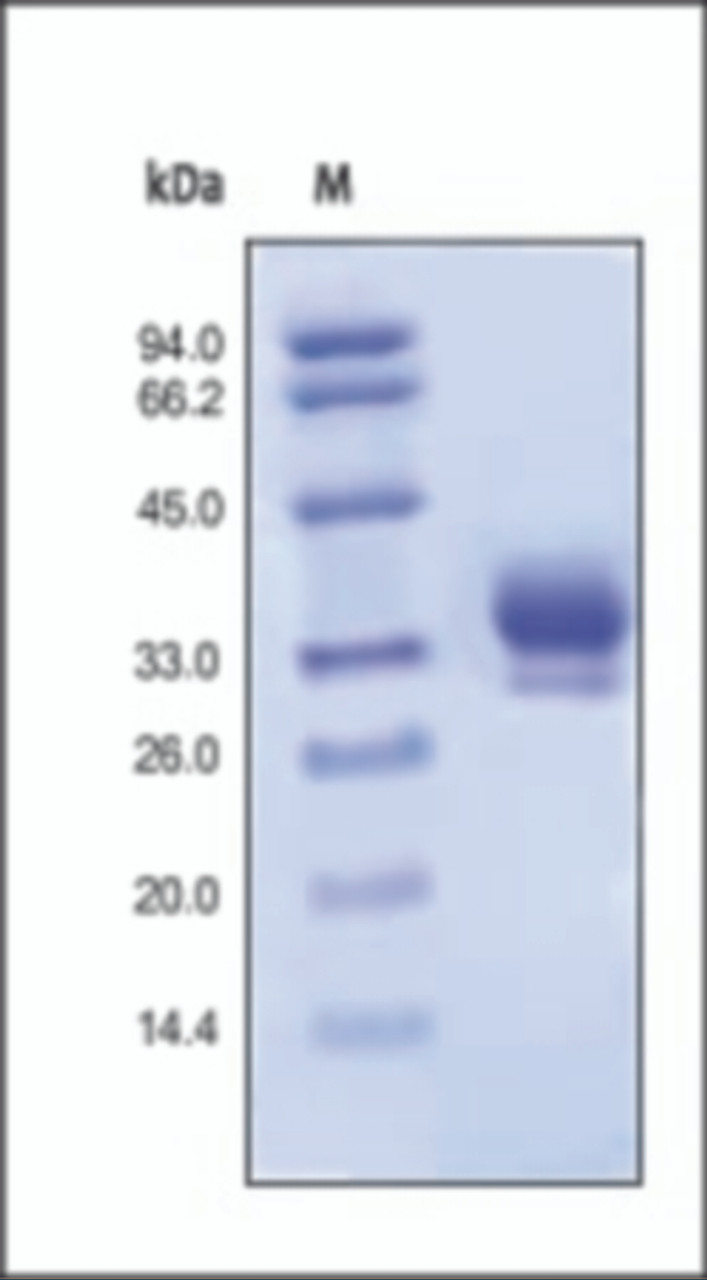 The purity of rh IL29 was determined by DTT-reduced (+) SDS-PAGE and staining overnight with Coomassie Blue.
