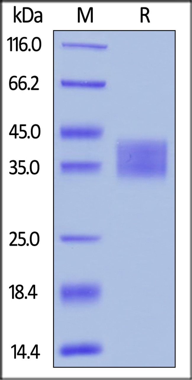 Human IL-2 R alpha, His Tag on SDS-PAGE under reducing (R) condition. The gel was stained overnight with Coomassie Blue. The purity of the protein is greater than 95%.
