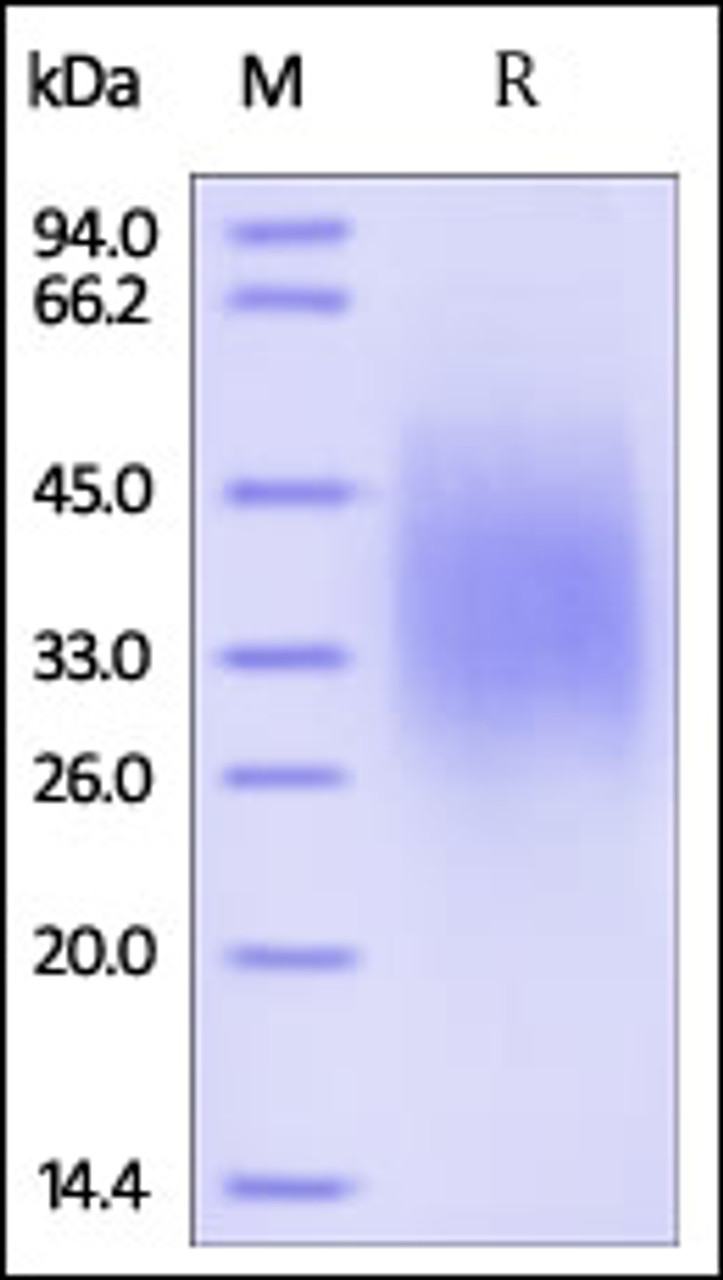 Human IL-18BP, His Tag on SDS-PAGE under reducing (R) condition. The gel was stained overnight with Coomassie Blue. The purity of the protein is greater than 95%.