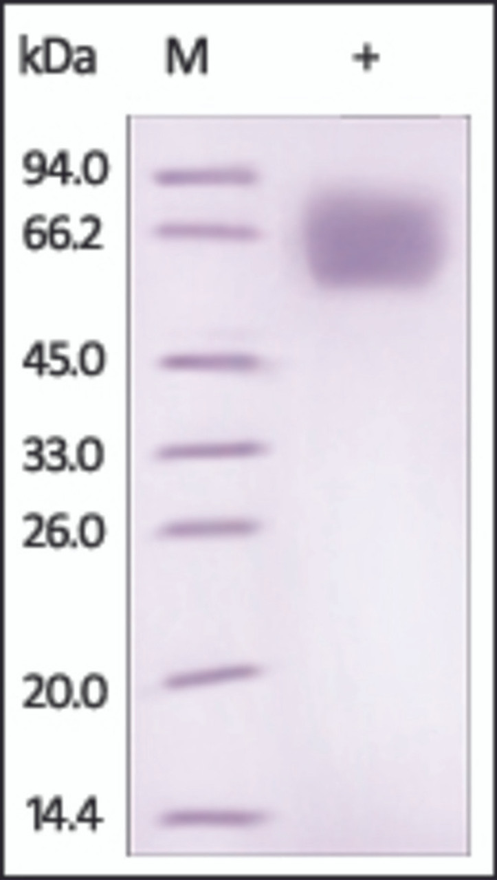 The purity of rh IL18BP /IL-18BPa Fc Chimera was determined by DTT-reduced (+) SDS-PAGE and staining overnight with Coomassie Blue.