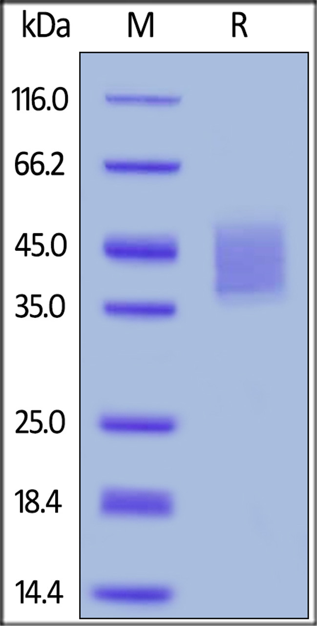 Human IL-4 R alpha, His Tag on SDS-PAGE under reducing (R) condition. The gel was stained overnight with Coomassie Blue. The purity of the protein is greater than 95%.