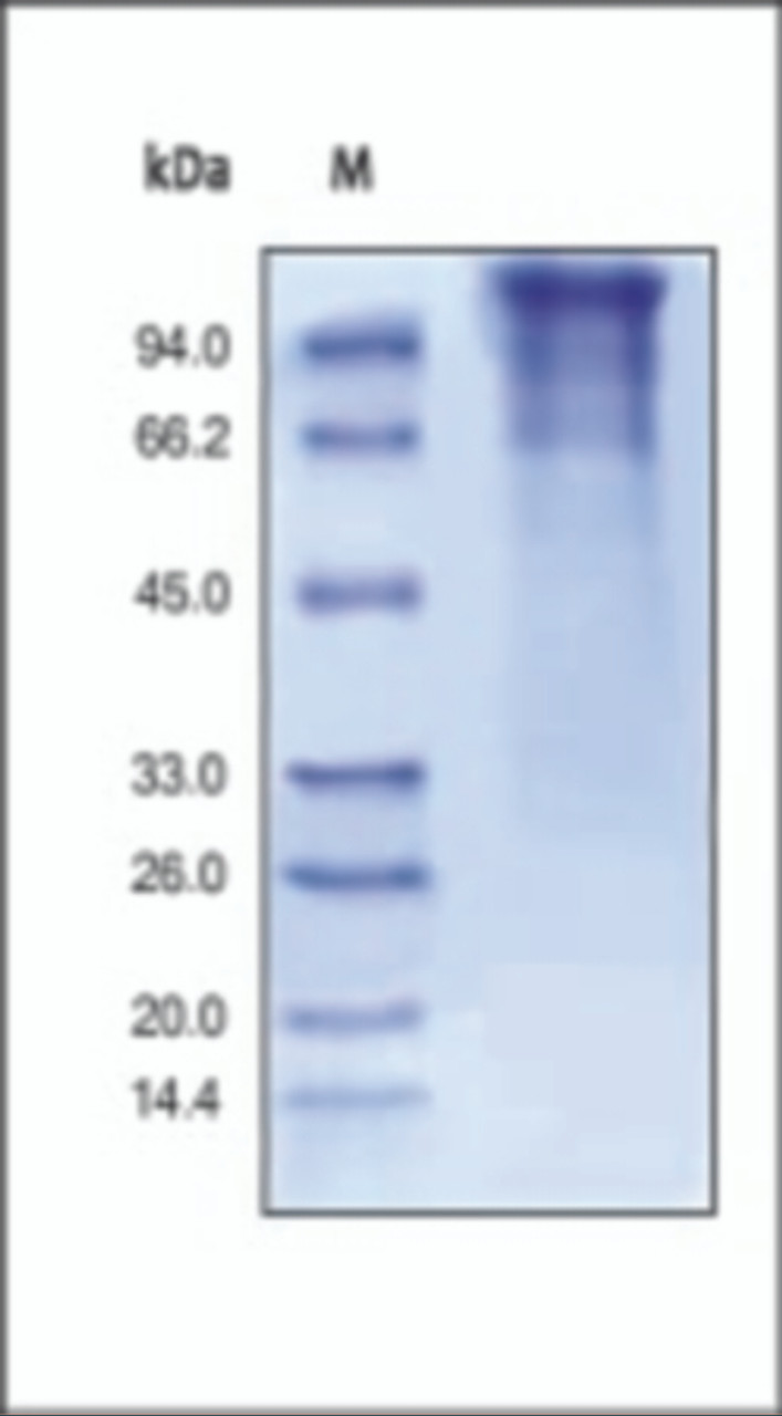 The purity of rh LDLR was determined by DTT-reduced (+) SDS-PAGE and staining overnight with Coomassie Blue.