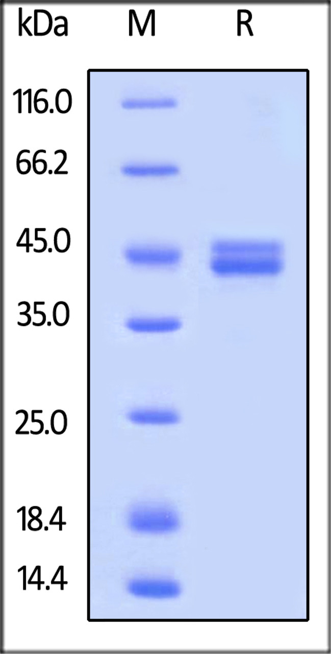 Human IL-12B, His Tag on SDS-PAGE under reducing (R) condition. The gel was stained overnight with Coomassie Blue. The purity of the protein is greater than 95%.