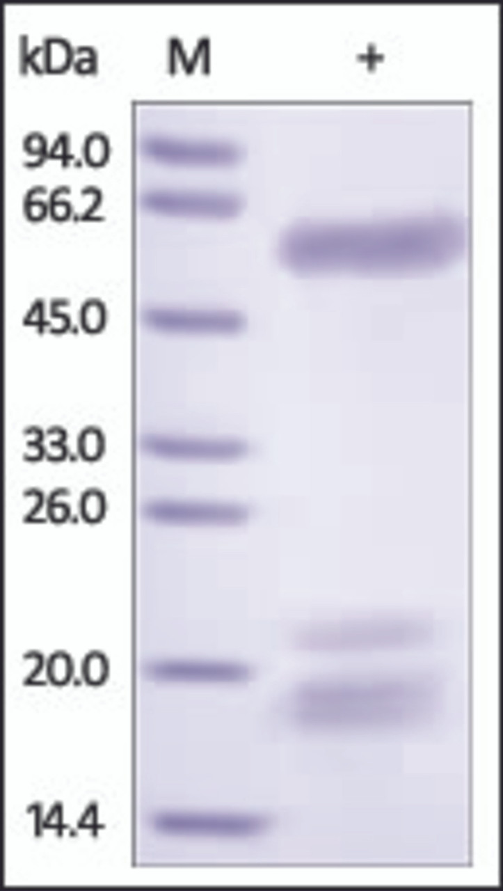 The purity of rh SPP1 / OPN was determined by DTT-reduced (+) SDS-PAGE and staining overnight with Coomassie Blue.