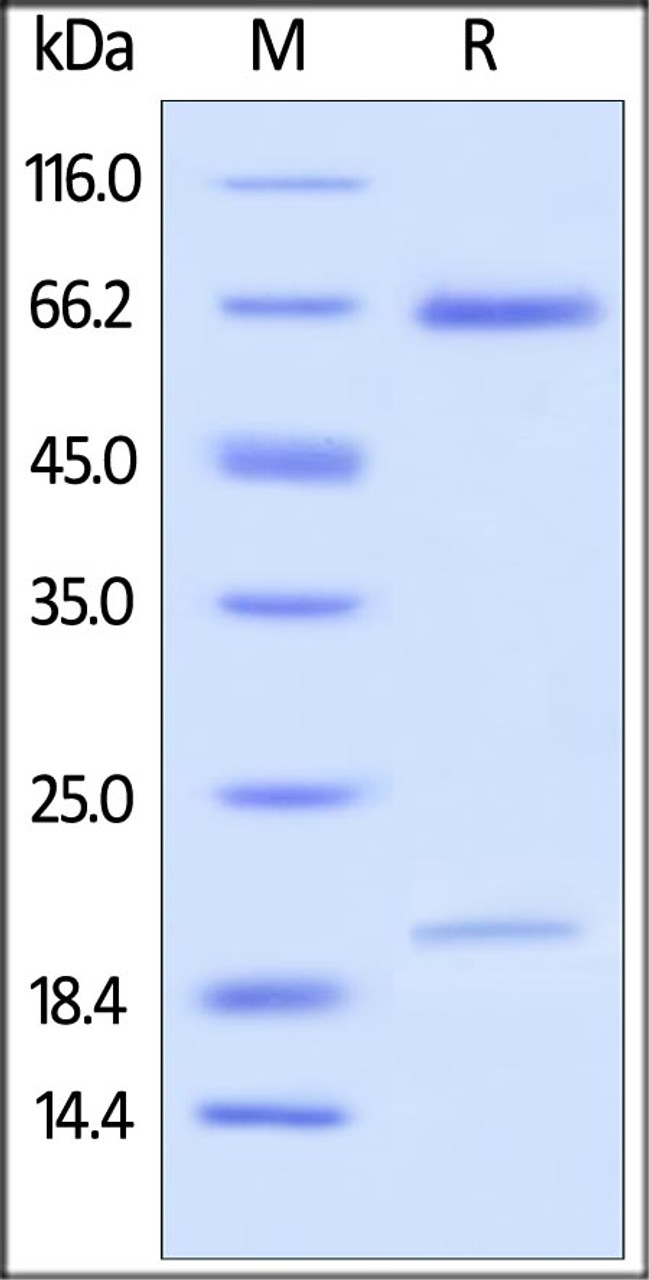 Human PCSK9, His Tag on SDS-PAGE under reducing (R) condition. The gel was stained overnight with Coomassie Blue. The purity of the protein is greater than 97%.