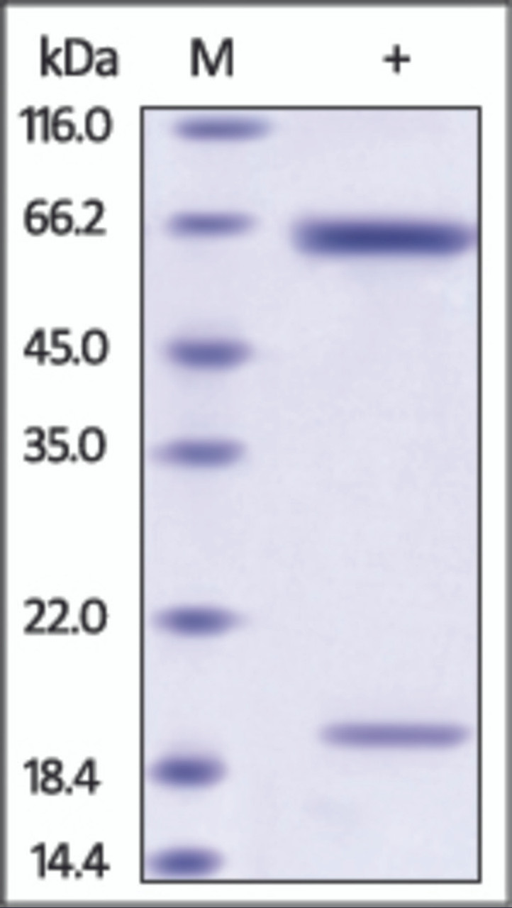The purity of Rat PCSK9 was determined by DTT-reduced (+) SDS-PAGE and staining overnight with Coomassie Blue.