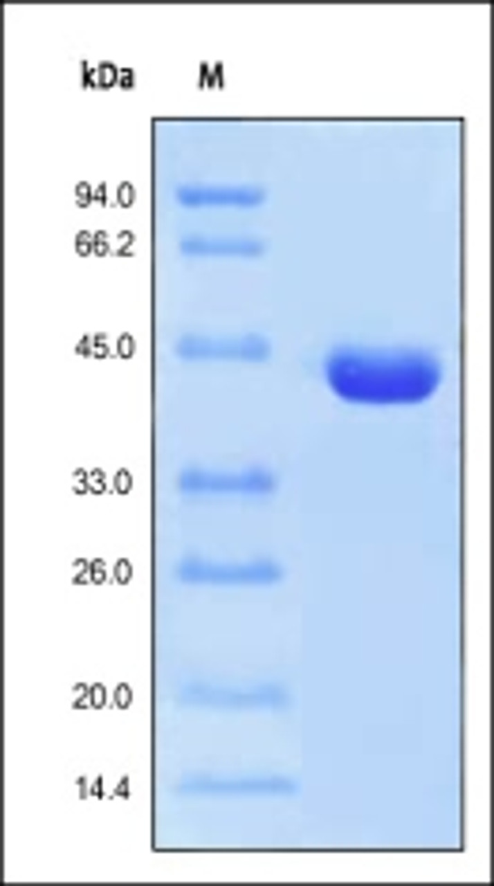 Recombinant Protein L, His Tag on SDS-PAGE under reducing (R) condition. The gel was stained overnight with Coomassie Blue. The purity of the protein is greater than 95%.