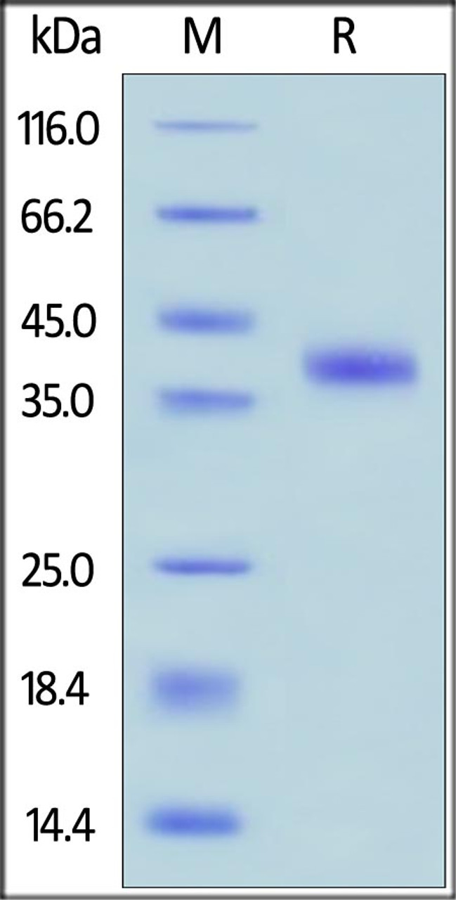 Human R-Spondin 1, His Tag on SDS-PAGE under reducing (R) condition. The gel was stained overnight with Coomassie Blue. The purity of the protein is greater than 95%.