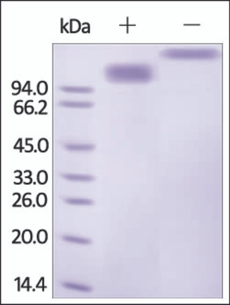 The purity of rh SCARB1 /SR-BI Fc Chimera was determined by DTT-reduced (+) and non-reduced (-) SDS-PAGE and staining overnight with Coomassie Blue.