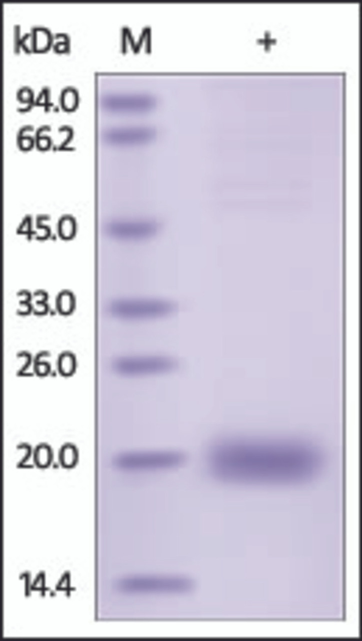 The purity of rh SECTM1 / K12 was determined by DTT-reduced (+) SDS-PAGE and staining overnight with Coomassie Blue.