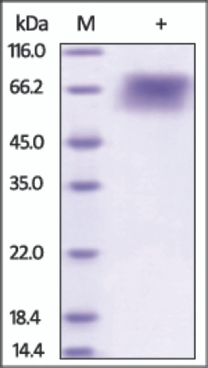 The purity of rh THSD1 / TMTSP was determined by DTT-reduced (+) SDS-PAGE and staining overnight with Coomassie Blue.