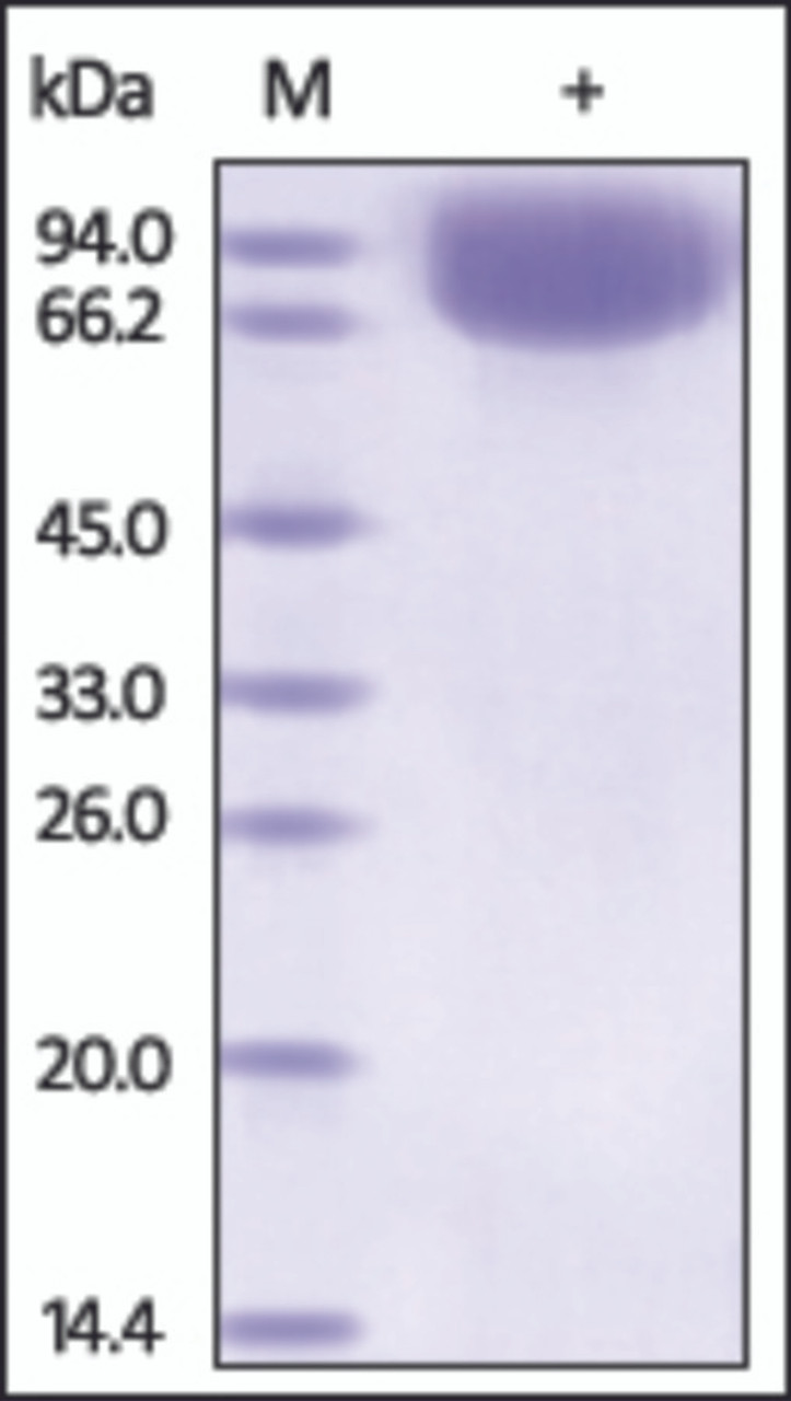 The purity of rh VASN / Vasorin was determined by DTT-reduced (+) SDS-PAGE and staining overnight with Coomassie Blue.