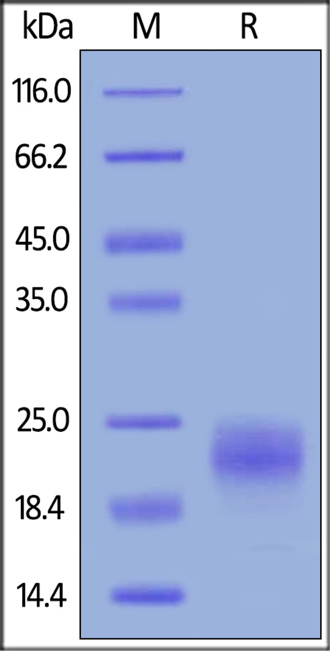 Human VEGF-C, His Tag on SDS-PAGE under reducing (R) condition. The gel was stained overnight with Coomassie Blue. The purity of the protein is greater than 95%.