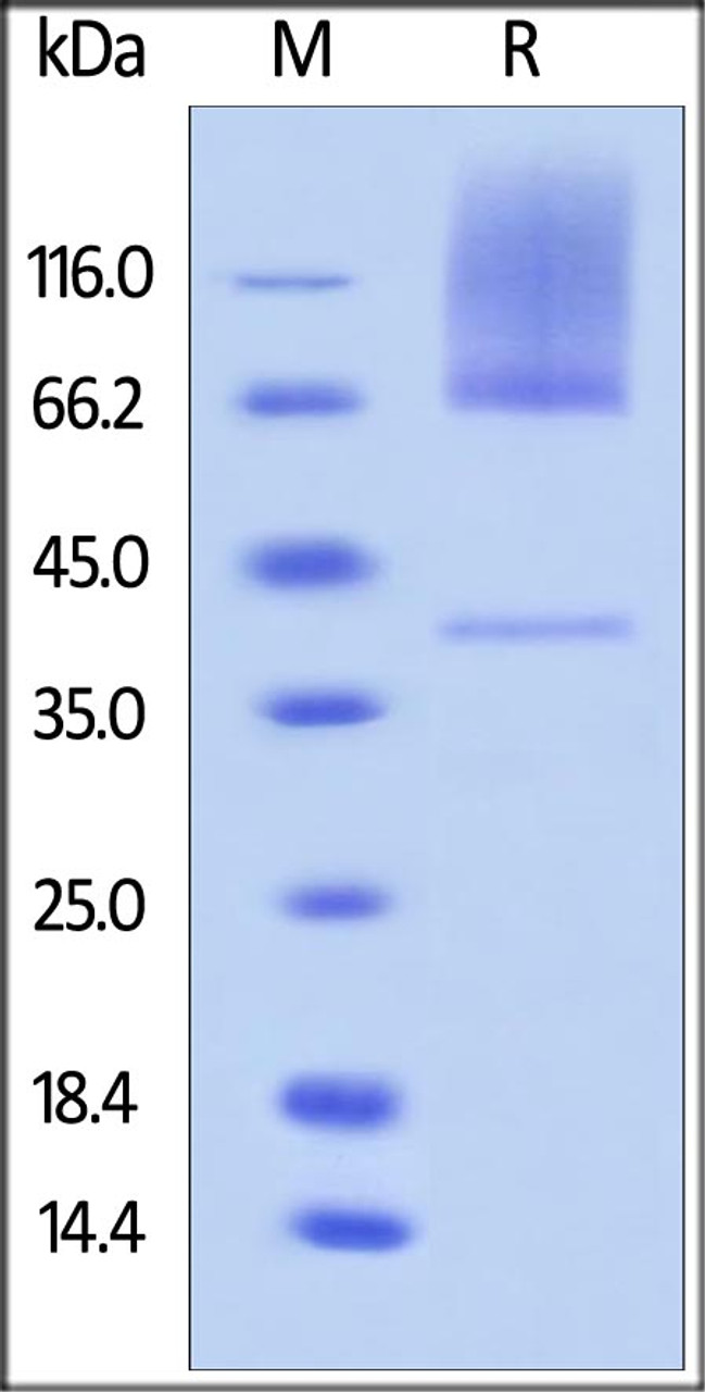 Cynomolgus Glypican 3, His Tag on SDS-PAGE under reducing (R) condition. The gel was stained overnight with Coomassie Blue. The purity of the protein is greater than 85%.