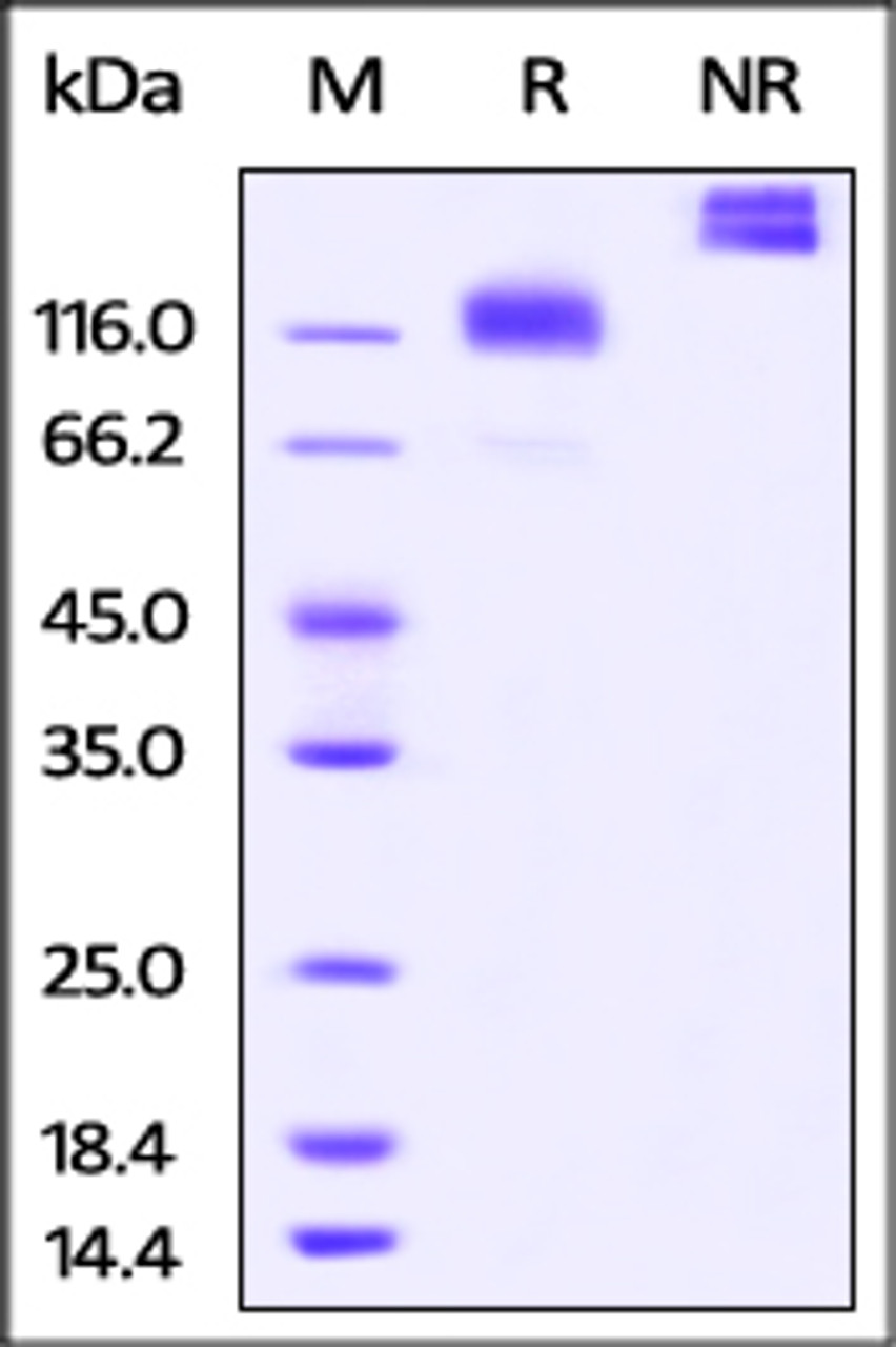 Cynomolgus M-CSF R, Fc Tag on SDS-PAGE under reducing (R) and non-reducing (NR) conditions. The gel was stained overnight with Coomassie Blue. The purity of the protein is greater than 95%.