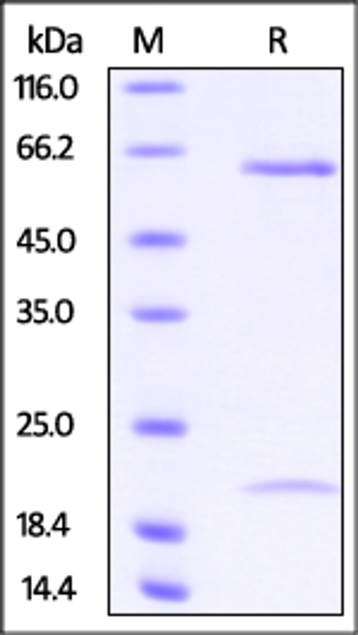 Cynomolgus PCSK9, His Tag on SDS-PAGE under reducing (R) condition. The gel was stained overnight with Coomassie Blue. The purity of the protein is greater than 95%.