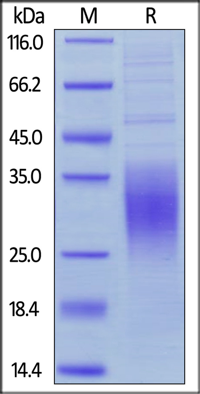 Human BTLA, His Tag on SDS-PAGE under reducing (R) condition. The gel was stained overnight with Coomassie Blue. The purity of the protein is greater than 90%.