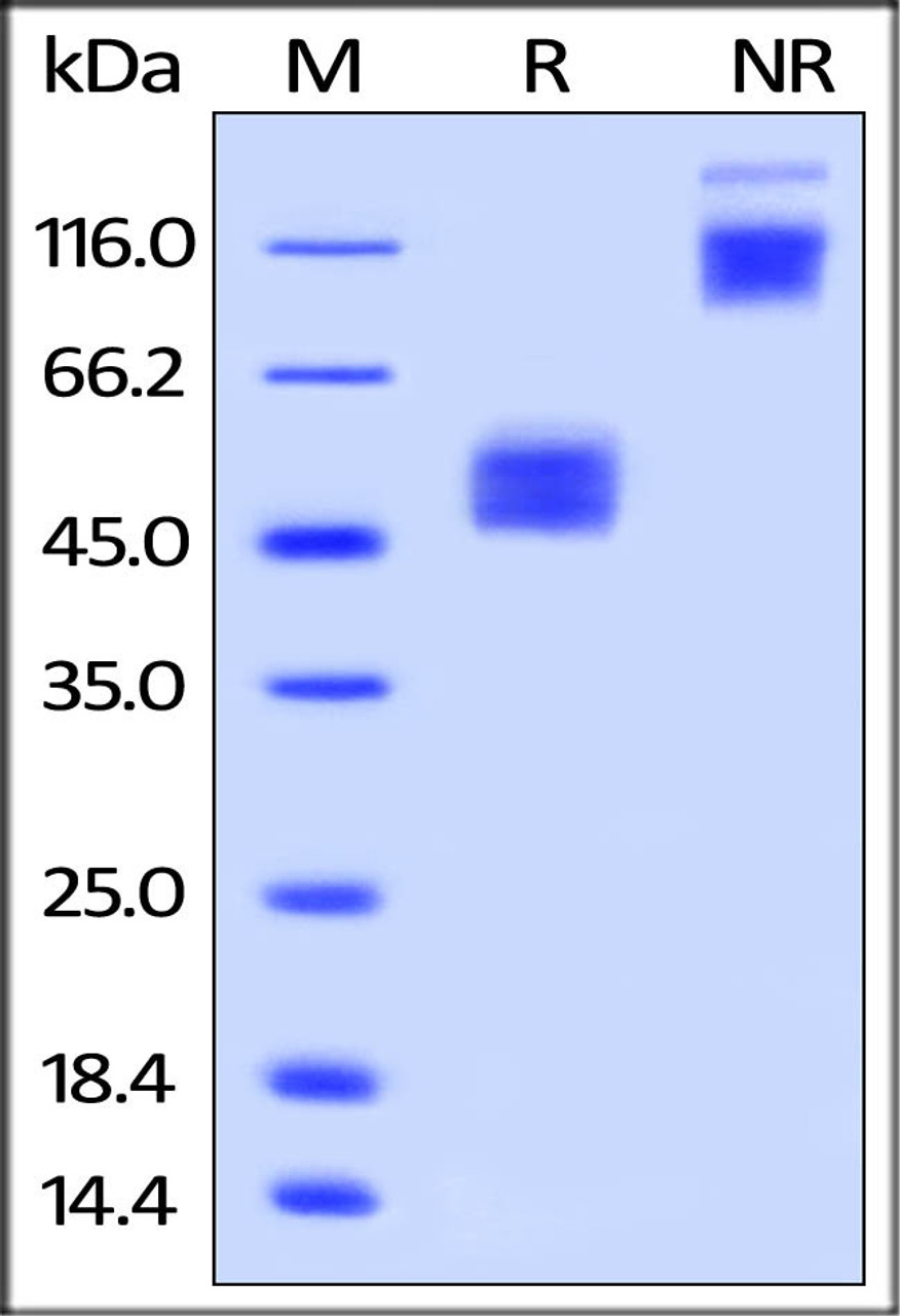 Human CD28H / IGPR-1, Fc Tag on SDS-PAGE under reducing (R) and no-reducing (NR) conditions. The gel was stained overnight with Coomassie Blue. The purity of the protein is greater than 95%.