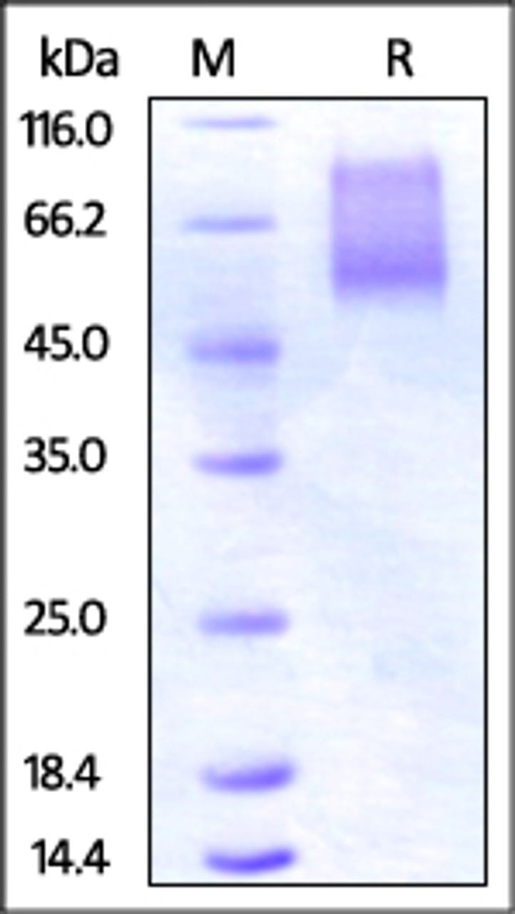 Human CX3CL1, His Tag on SDS-PAGE under reducing (R) condition. The gel was stained overnight with Coomassie Blue. The purity of the protein is greater than 95%.