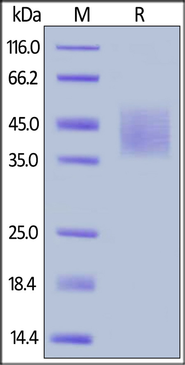 Human DNAM-1, His Tag on SDS-PAGE under reducing (R) condition. The gel was stained overnight with Coomassie Blue. The purity of the protein is greater than 95%.