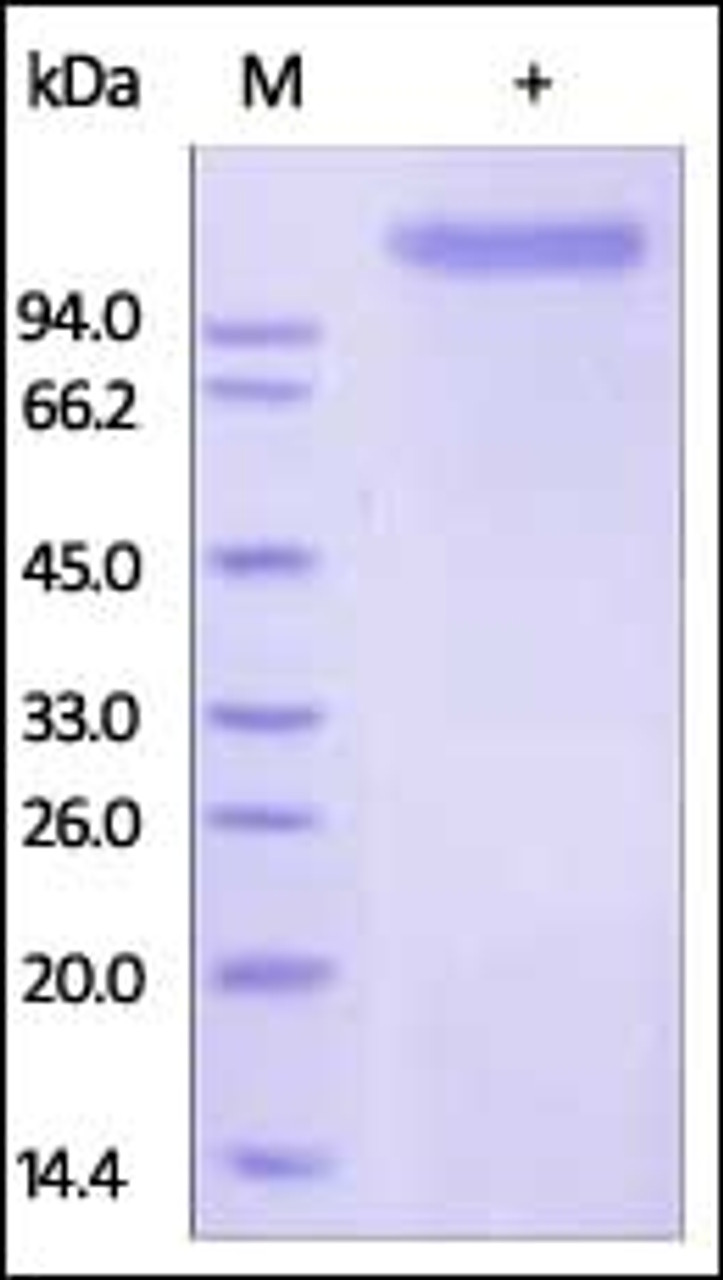 Human E-Selectin, Fc Tag on SDS-PAGE under reducing (R) condition. The gel was stained overnight with Coomassie Blue. The purity of the protein is greater than 95%.