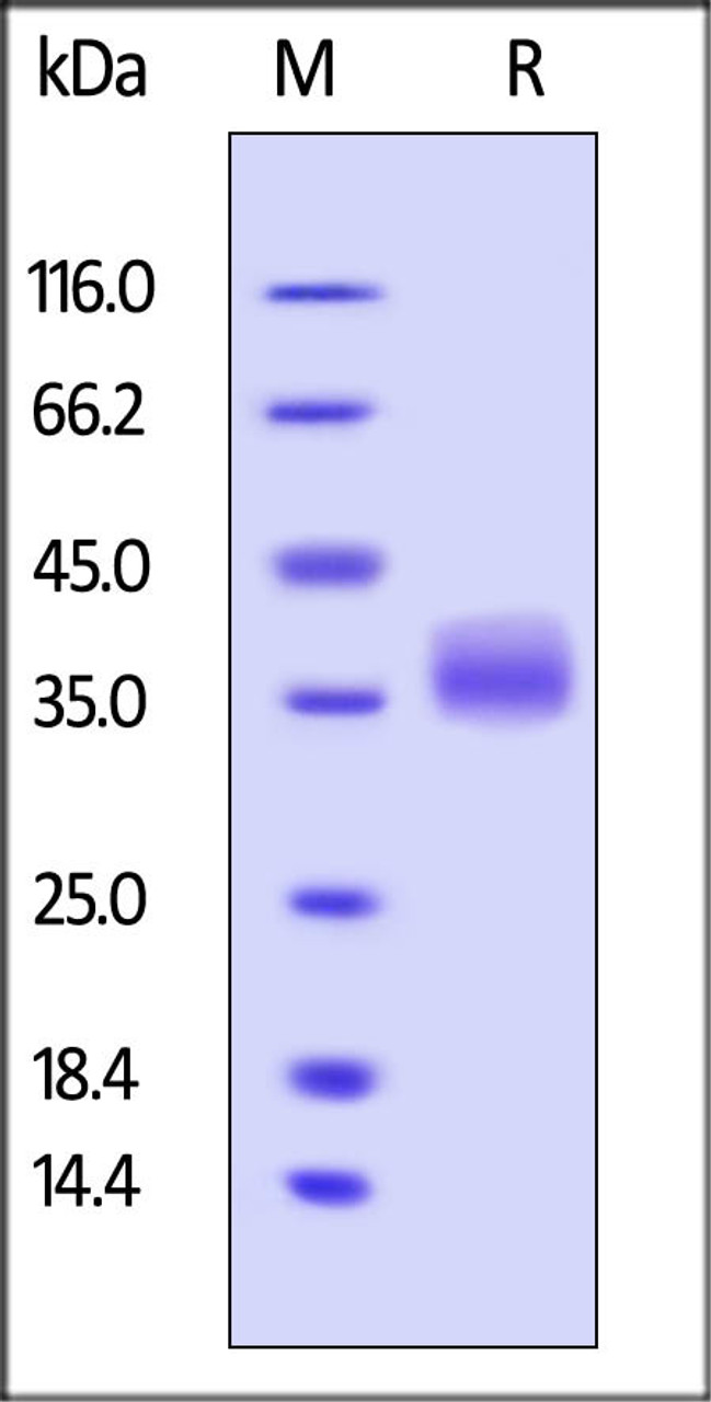 Human Galectin-3, His Tag on SDS-PAGE under reducing (R) condition. The gel was stained overnight with Coomassie Blue. The purity of the protein is greater than 95%.