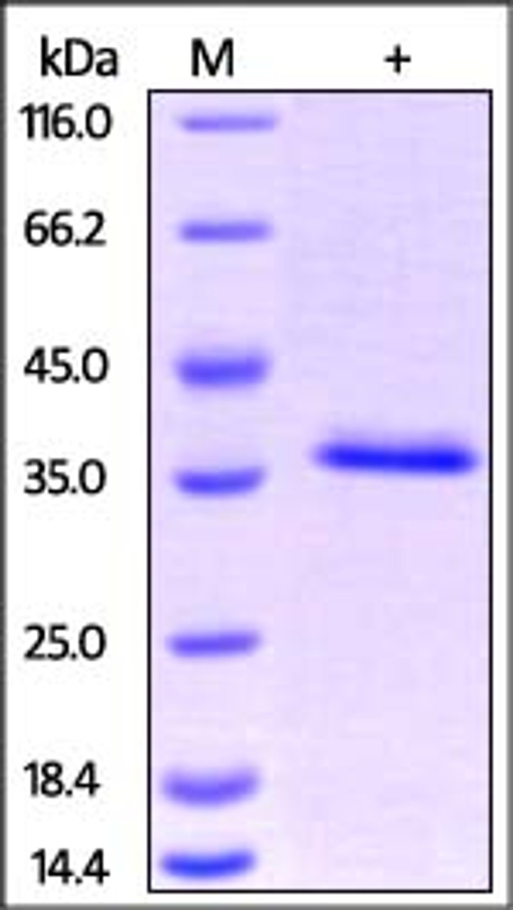 Human HABP1, His Tag on SDS-PAGE under reducing (R) condition. The gel was stained overnight with Coomassie Blue. The purity of the protein is greater than 95%.