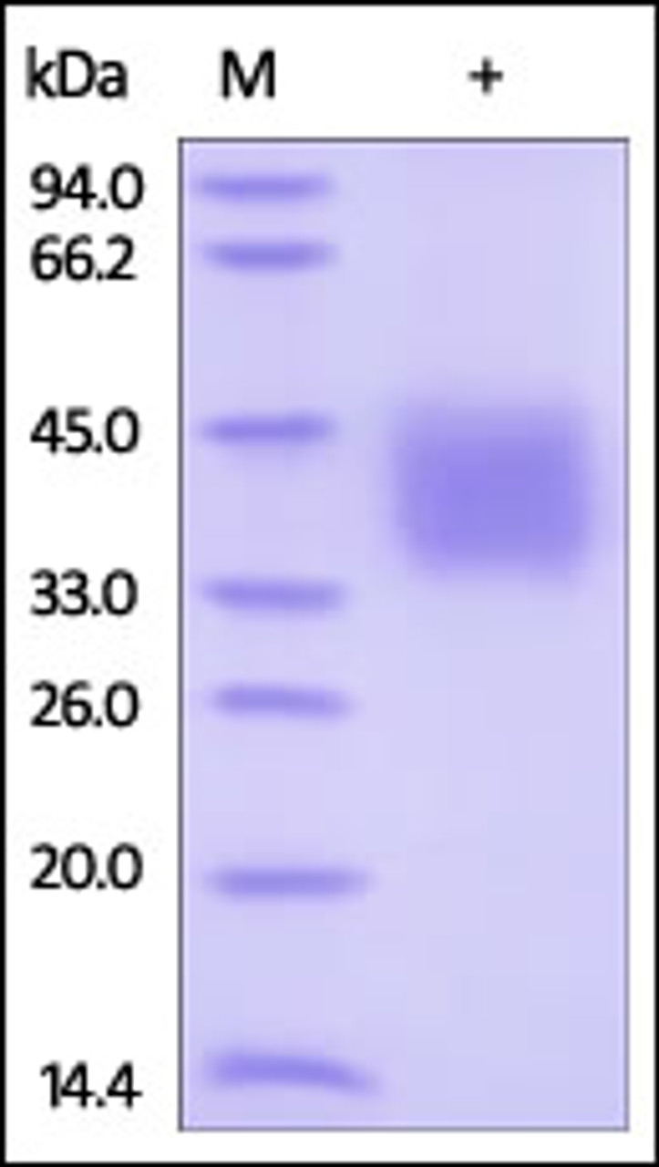 Human IFN-gamma R1, His Tag on SDS-PAGE under reducing (R) condition. The gel was stained overnight with Coomassie Blue. The purity of the protein is greater than 95%.