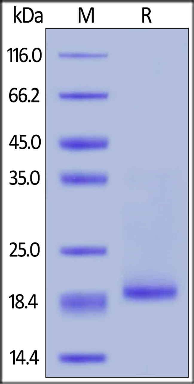 Human IL-10, His Tag on SDS-PAGE under reducing (R) condition. The gel was stained overnight with Coomassie Blue. The purity of the protein is greater than 95%.