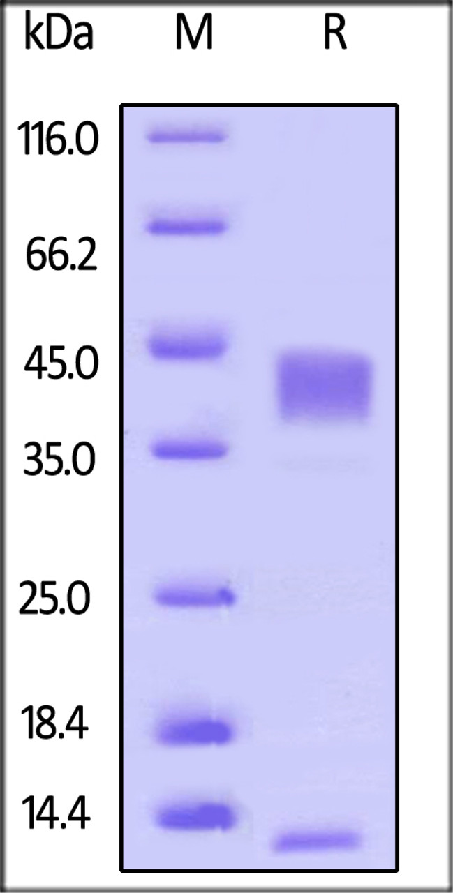 Human Latent TGFB1, His Tag on SDS-PAGE under reducing (R) and no-reducing (NR) conditions. The gel was stained overnight with Coomassie Blue. The purity of the protein is greater than 95%.