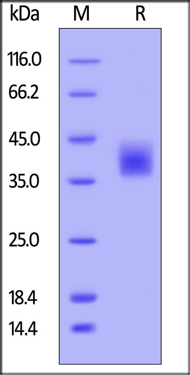 Human M-CSF, His Tag on SDS-PAGE under reducing (R) condition. The gel was stained overnight with Coomassie Blue. The purity of the protein is greater than 95%.