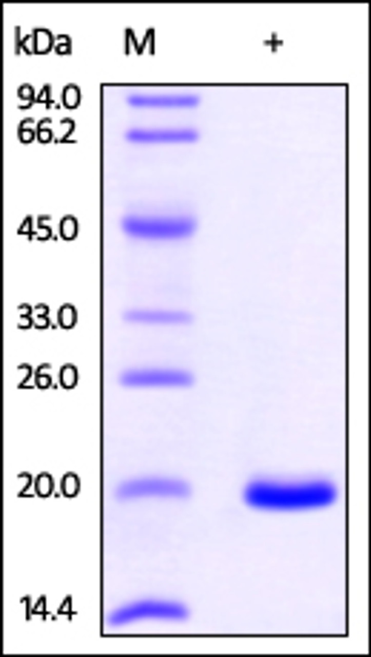 Human NME1, His Tag on SDS-PAGE under reducing (R) condition. The gel was stained overnight with Coomassie Blue. The purity of the protein is greater than 98%.