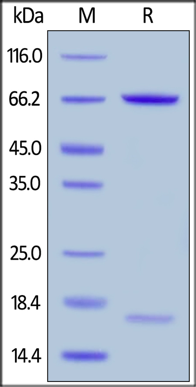 Human PCSK9 (R194A) , His Tag on SDS-PAGE under reducing (R) condition. The gel was stained overnight with Coomassie Blue. The purity of the protein is greater than 95%.