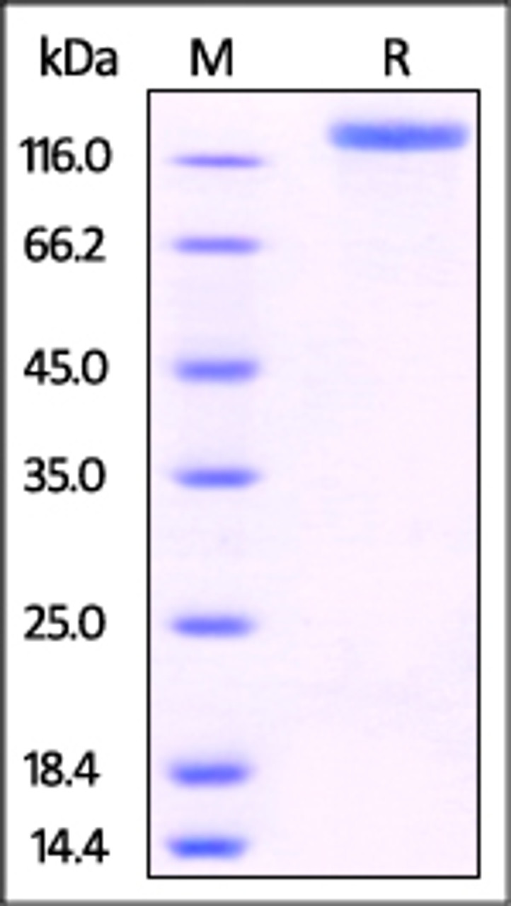 Human P-Selectin, Fc Tag on SDS-PAGE under reducing (R) condition. The gel was stained overnight with Coomassie Blue. The purity of the protein is greater than 95%.