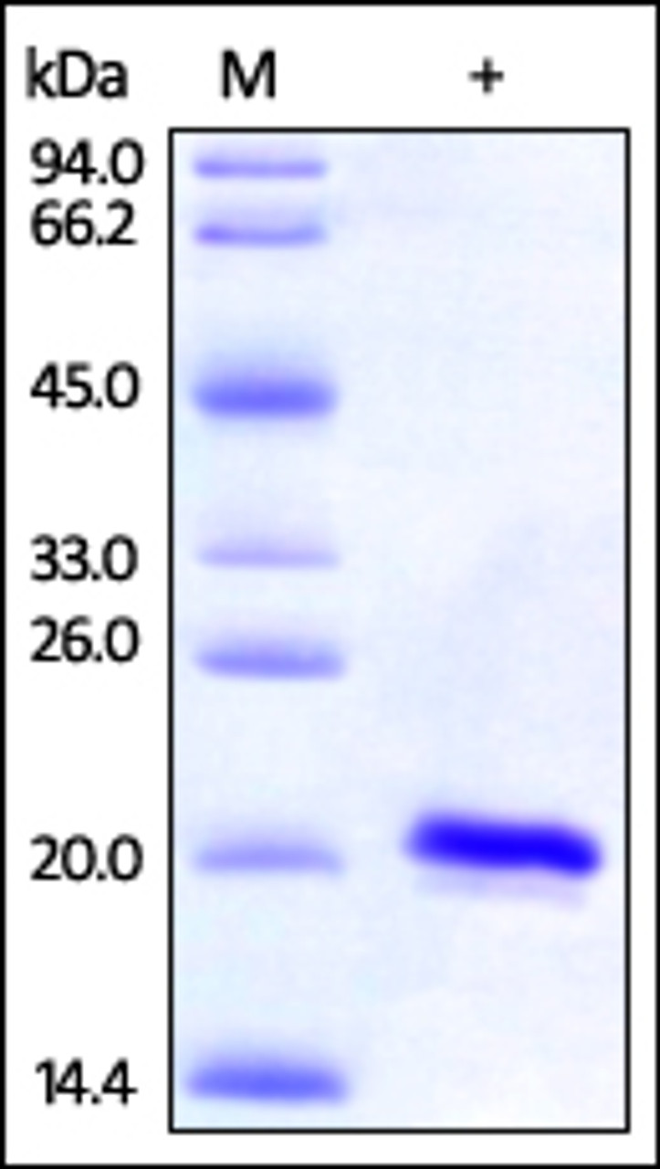 Human SOD1, His Tag on SDS-PAGE under reducing (R) condition. The gel was stained overnight with Coomassie Blue. The purity of the protein is greater than 97%.