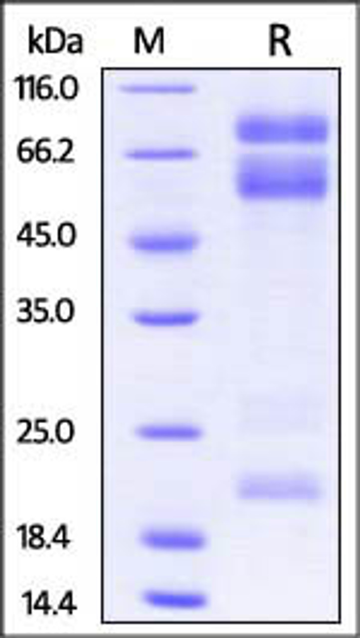Mouse ADAM17, His Tag on SDS-PAGE under reducing (R) condition. The gel was stained overnight with Coomassie Blue. The purity of the protein is greater than 90%.