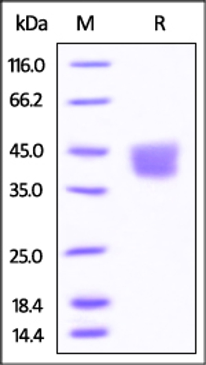 Mouse B7-H3, His Tag on SDS-PAGE under reducing (R) condition. The gel was stained overnight with Coomassie Blue. The purity of the protein is greater than 95%.