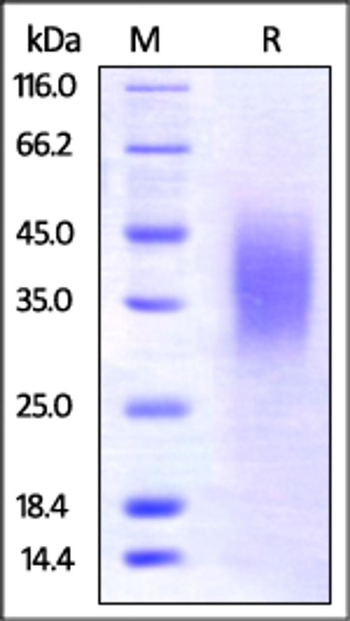 Mouse BTLA, His Tag on SDS-PAGE under reducing (R) condition. The gel was stained overnight with Coomassie Blue. The purity of the protein is greater than 95%.