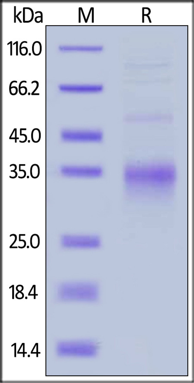 Mouse CD28, His Tag on SDS-PAGE under reducing (R) condition. The gel was stained overnight with Coomassie Blue. The purity of the protein is greater than 90%.