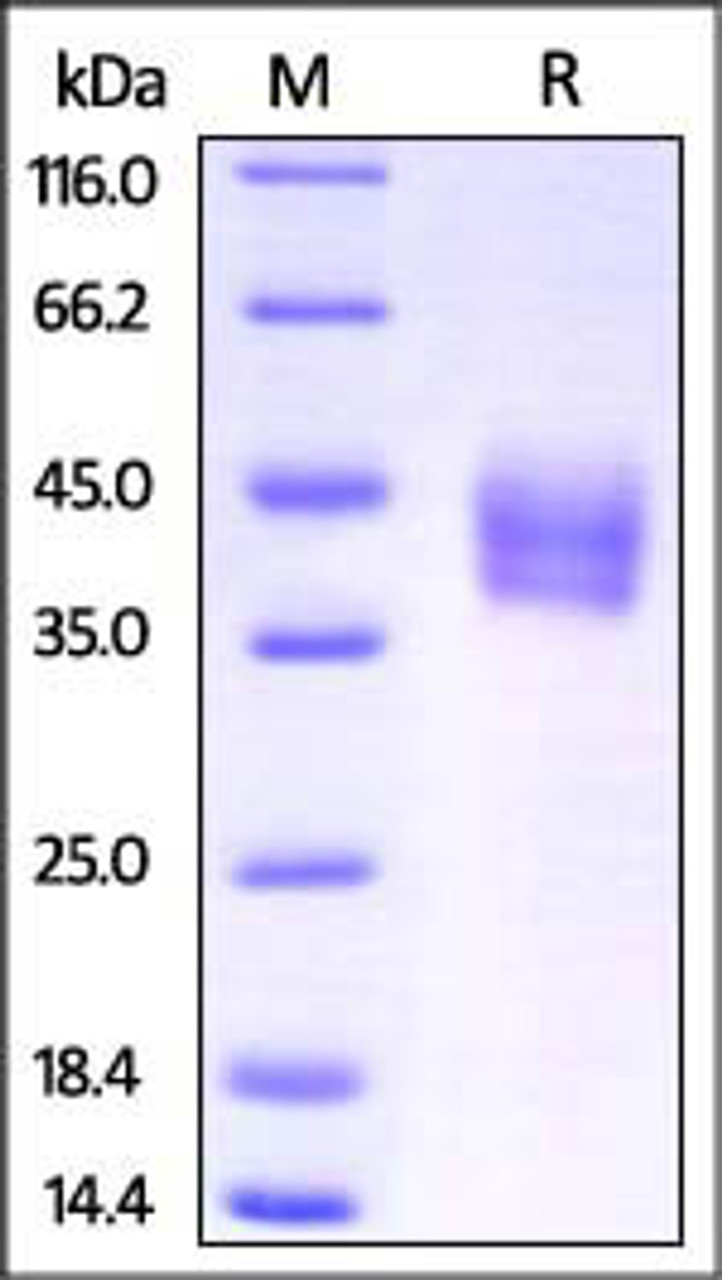 Mouse IL-4 R alpha, His Tag on SDS-PAGE under reducing (R) condition. The gel was stained overnight with Coomassie Blue. The purity of the protein is greater than 95%.