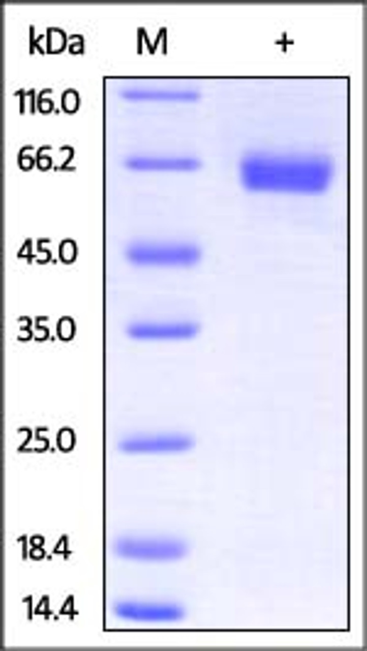 Mouse IL-4 R alpha, Fc Tag on SDS-PAGE under reducing (R) condition. The gel was stained overnight with Coomassie Blue. The purity of the protein is greater than 95%.