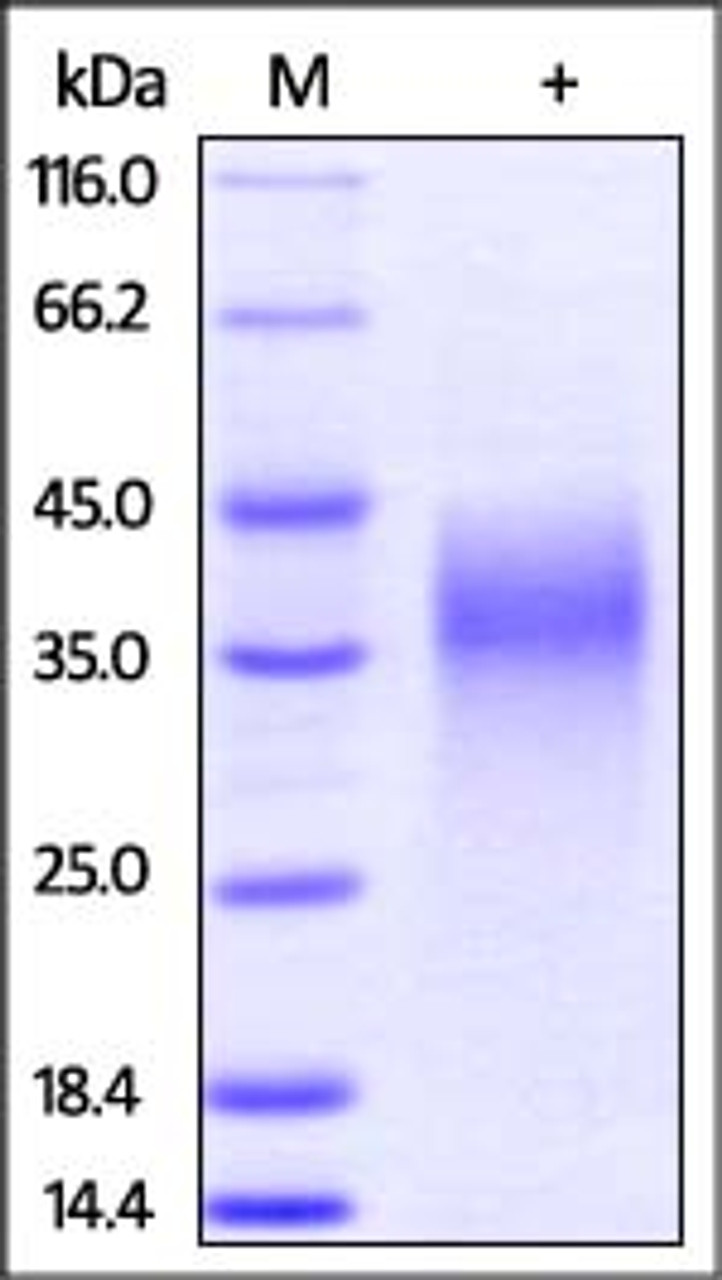 Mouse LIF, His Tag on SDS-PAGE under reducing (R) condition. The gel was stained overnight with Coomassie Blue. The purity of the protein is greater than 92%.