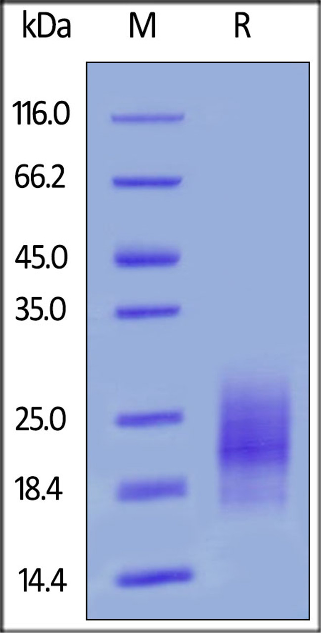 Mouse TIGIT, His Tag on SDS-PAGE under reducing (R) condition. The gel was stained overnight with Coomassie Blue. The purity of the protein is greater than 90%.