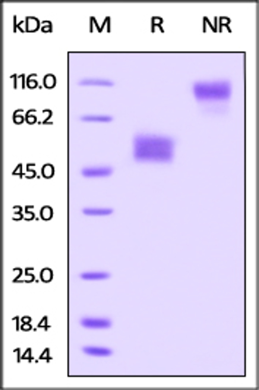 Rat TIGIT, Fc Tag on SDS-PAGE under reducing (R) and no-reducing (NR) conditions. The gel was stained overnight with Coomassie Blue. The purity of the protein is greater than 95%.