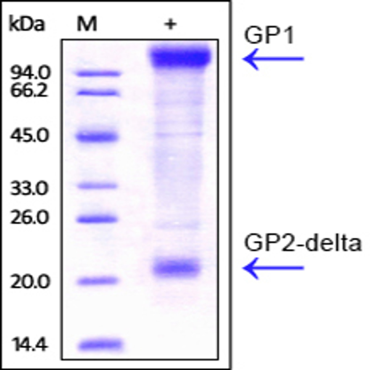 Ebolavirus EBOV (subtype Zaire, strain Kikwit-95) GP, His Tag on SDS-PAGE under reducing (R) condition. The gel was stained overnight with Coomassie Blue. The purity of the protein is greater than 85%.